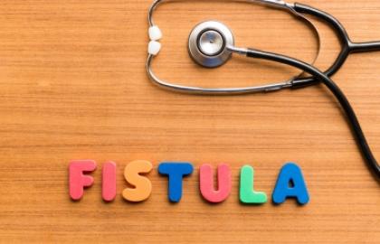 Fistula